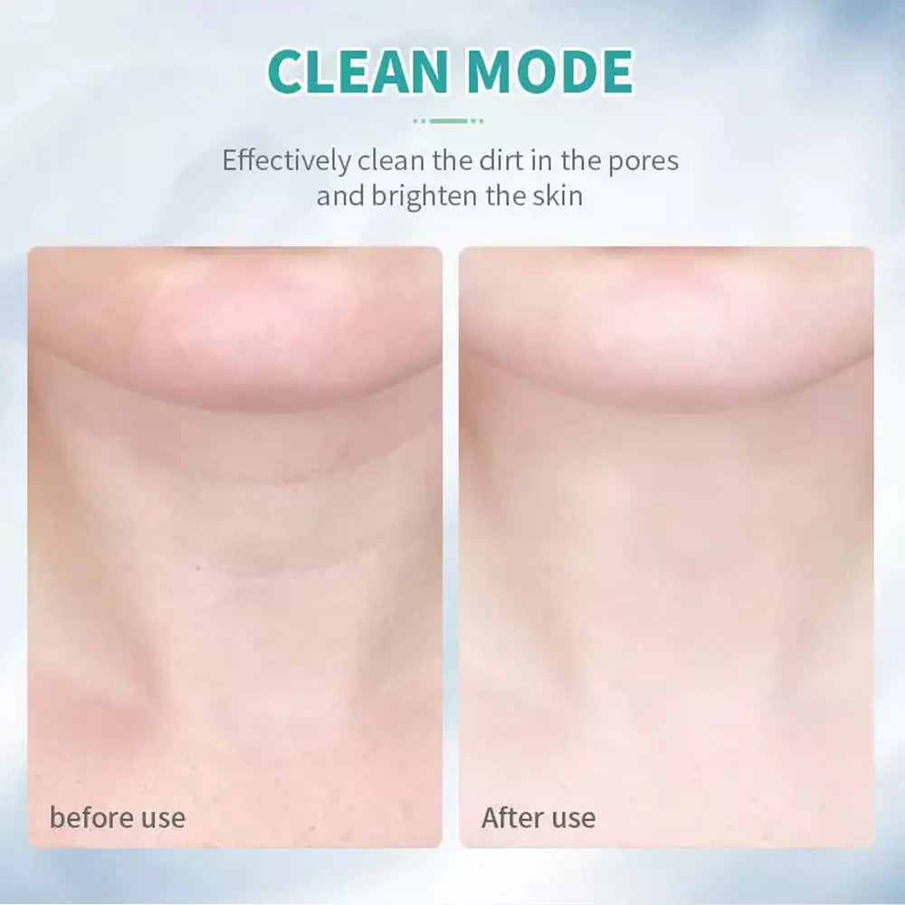 SmoothPro | Anti-Falten- und Facelift-Massagegerät für Gesicht und Hals | 50% RABATT